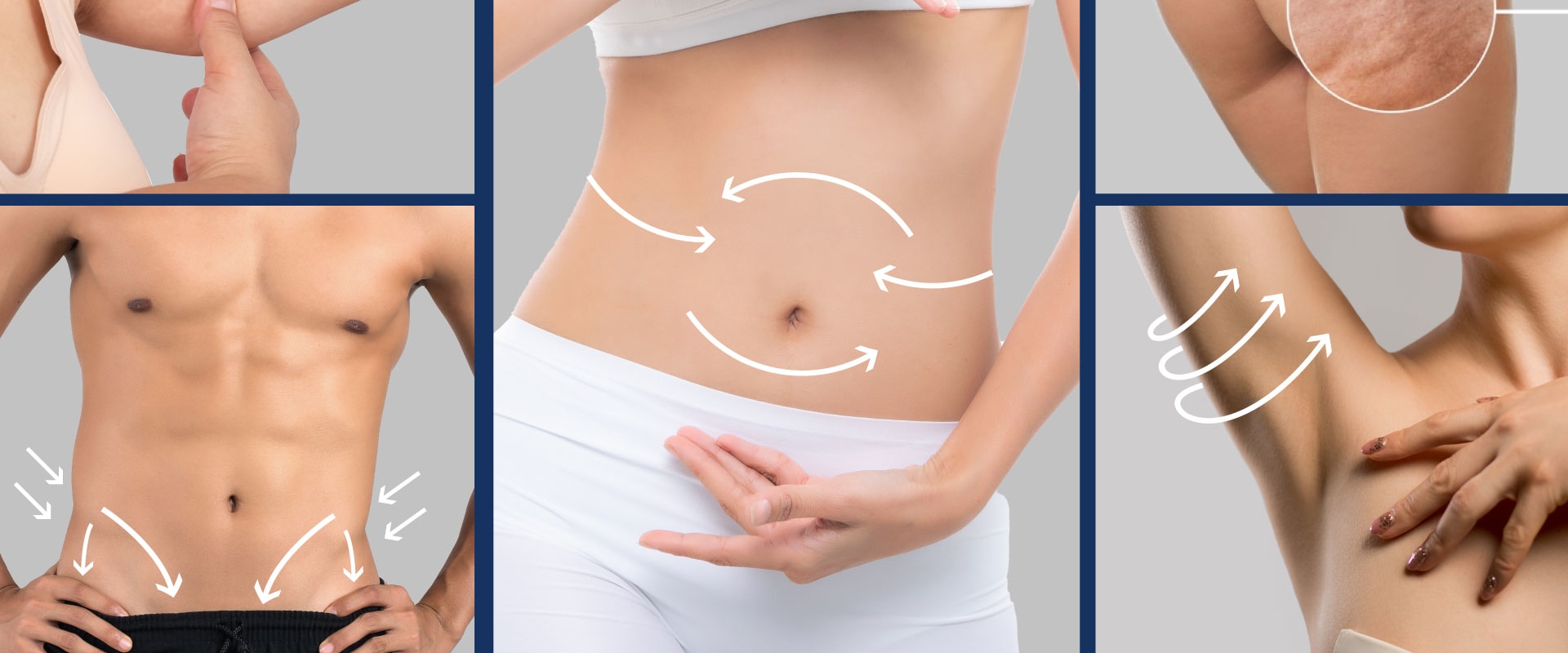 Non-Invasive Fat Reduction: What Areas of the Body Can Be Treated?