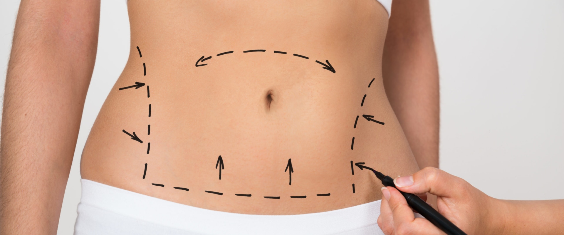 Comparing Liposuction and CoolSculpting: Which Fat Reduction Treatment is Right for You?