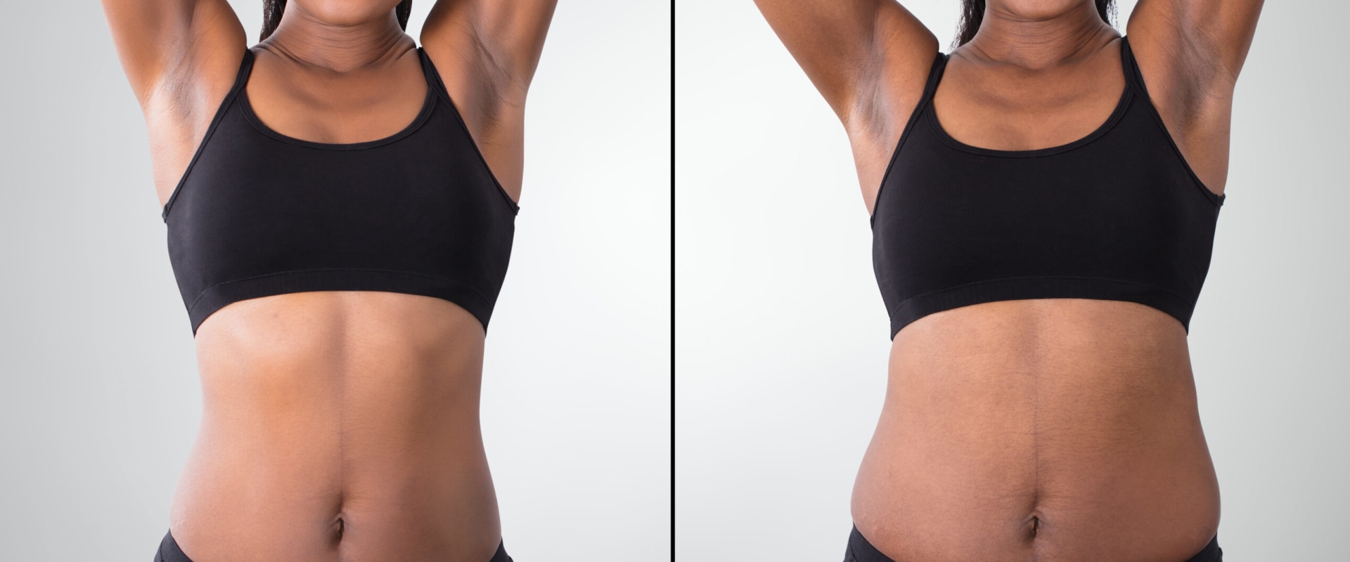 Does Fat Reduction Really Work?