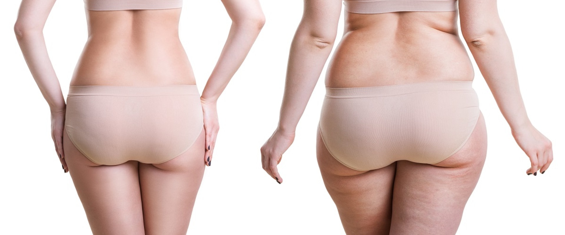 Combining Different Types of Surgical Fat Reduction Treatments for Better Results