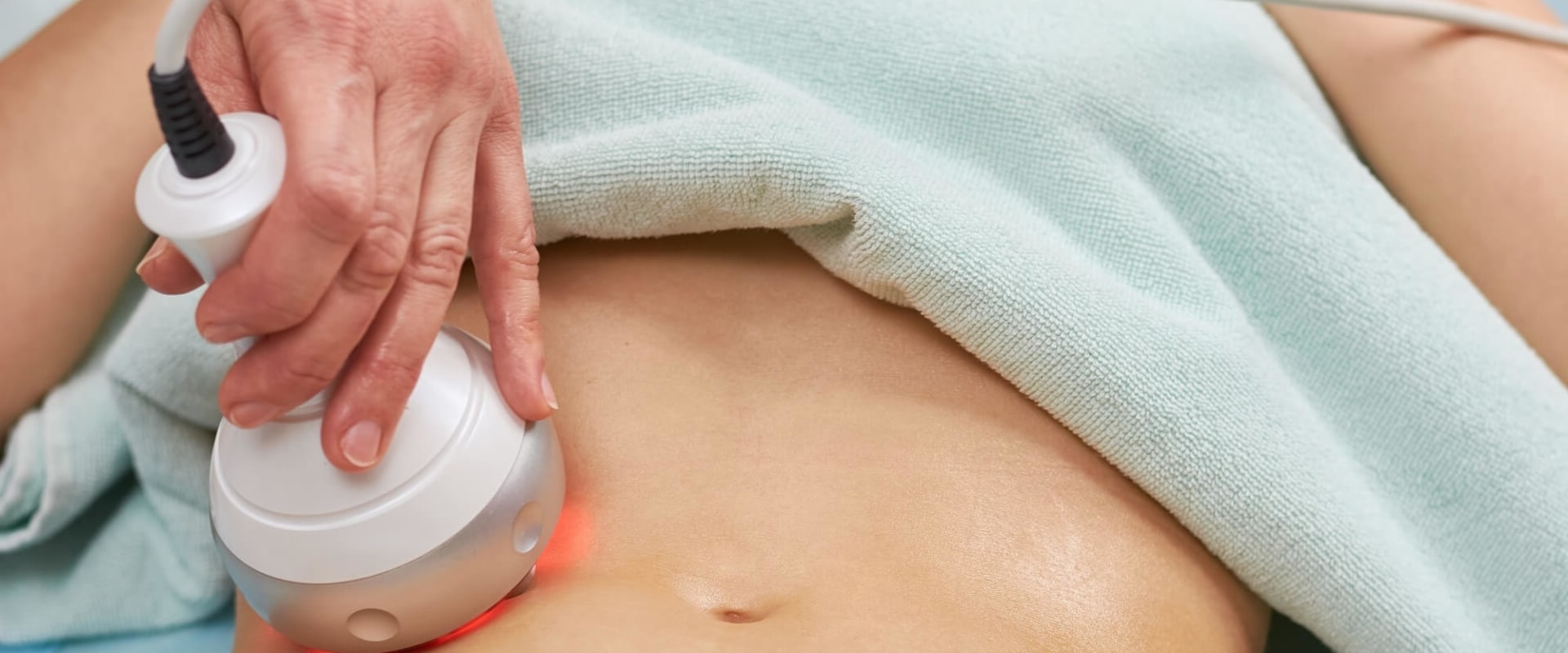 The Benefits of Non-Invasive Fat Reduction Treatments