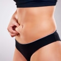 Maintaining Results from Fat Reduction Treatments: A Guide