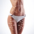 How Long Does It Take to Recover from Fat Reduction Surgery?