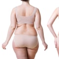 Combining Different Types of Surgical Fat Reduction Treatments for Better Results