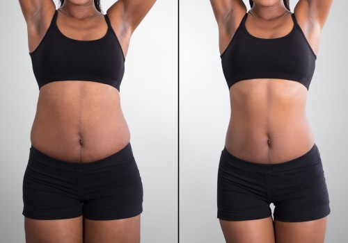 Combining Non-Surgical Fat Reduction Treatments for Optimal Results